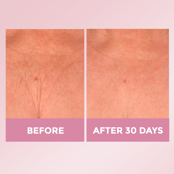 Luxe Skin Lift Cream