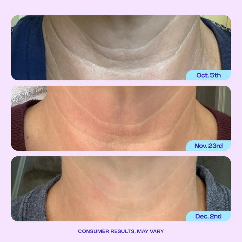 Neck Revival Cream